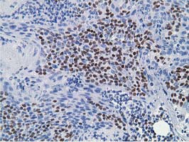 HOXC11 Antibody - IHC of paraffin-embedded Human lymph node tissue using anti-HOXC11 mouse monoclonal antibody.