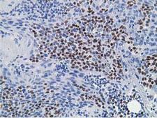 HOXC11 Antibody - IHC of paraffin-embedded Human lymph node tissue using anti-HOXC11 mouse monoclonal antibody.