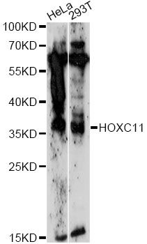 HOXC11 Antibody - Western blot analysis of extracts of various cell lines, using HOXC11 antibody at 1:1000 dilution. The secondary antibody used was an HRP Goat Anti-Rabbit IgG (H+L) at 1:10000 dilution. Lysates were loaded 25ug per lane and 3% nonfat dry milk in TBST was used for blocking. An ECL Kit was used for detection and the exposure time was 5min.