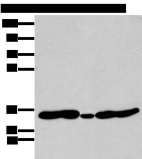 HOXC11 Antibody - Western blot analysis of 231 Mouse heart tissue Human fetal brain tissue Jurkat and Hepg2 cell  using HOXC11 Polyclonal Antibody at dilution of 1:250