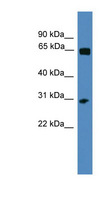 HOXC12 Antibody - HOXC12 antibody Western blot of ACHN lysate. This image was taken for the unconjugated form of this product. Other forms have not been tested.