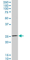 HOXC12 Antibody - HOXC12 monoclonal antibody (M01), clone 1C6. Western Blot analysis of HOXC12 expression in PC-12.