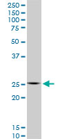 HOXC12 Antibody - HOXC12 monoclonal antibody (M01), clone 1C6. Western Blot analysis of HOXC12 expression in Raw 264.7.