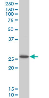 HOXC12 Antibody - HOXC12 monoclonal antibody (M01), clone 1C6 Western Blot analysis of HOXC12 expression in Jurkat.