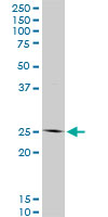 HOXC12 Antibody - HOXC12 monoclonal antibody (M01), clone 1C6. Western Blot analysis of HOXC12 expression in NIH/3T3.
