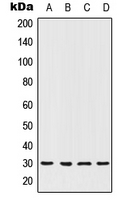 HOXC12 Antibody - Western blot analysis of HOXC12 expression in MCF7 (A); ACHN (B); NIH3T3 (C); PC12 (D) whole cell lysates.