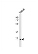HOXC12 Antibody - Anti-HOXC12 Antibody at 1:1000 dilution + HepG2 whole cell lysates Lysates/proteins at 20 ug per lane. Secondary Goat Anti-Rabbit IgG, (H+L),Peroxidase conjugated at 1/10000 dilution Predicted band size : 30 kDa Blocking/Dilution buffer: 5% NFDM/TBST.