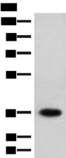 HOXC12 Antibody - Western blot analysis of Jurkat cell lysate  using HOXC12 Polyclonal Antibody at dilution of 1:500