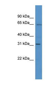 HOXC12 Antibody - HOXC12 antibody Western blot of Mouse Liver lysate. This image was taken for the unconjugated form of this product. Other forms have not been tested.
