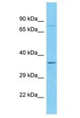 HOXC13 Antibody - HOXC13 antibody Western Blot of HepG2. Antibody dilution: 1 ug/ml.  This image was taken for the unconjugated form of this product. Other forms have not been tested.