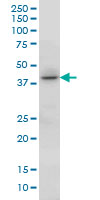 HOXC13 Antibody - HOXC13 monoclonal antibody (M01), clone 10D4 Western Blot analysis of HOXC13 expression in A-549.