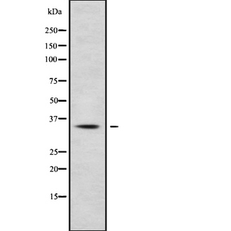 HOXC13 Antibody - Western blot analysis of HOXC13 using HepG2 whole cells lysates