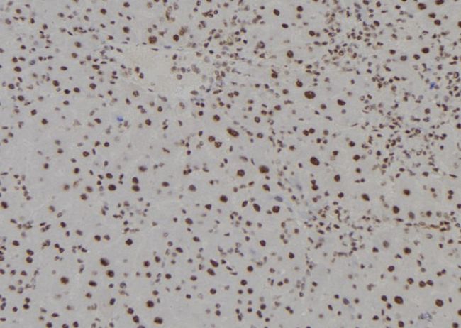HOXC13 Antibody - 1:100 staining mouse liver tissue by IHC-P. The sample was formaldehyde fixed and a heat mediated antigen retrieval step in citrate buffer was performed. The sample was then blocked and incubated with the antibody for 1.5 hours at 22°C. An HRP conjugated goat anti-rabbit antibody was used as the secondary.