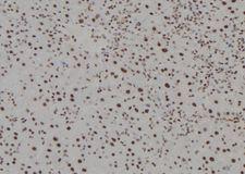 HOXC13 Antibody - 1:100 staining mouse liver tissue by IHC-P. The sample was formaldehyde fixed and a heat mediated antigen retrieval step in citrate buffer was performed. The sample was then blocked and incubated with the antibody for 1.5 hours at 22°C. An HRP conjugated goat anti-rabbit antibody was used as the secondary.