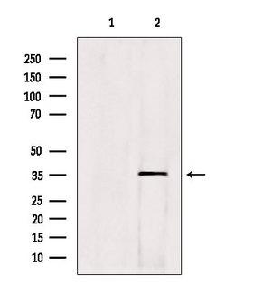 HOXC13 Antibody - Western blot analysis of extracts of c476 using HOXC13 antibody. Lane 1 was treated with the blocking peptide.