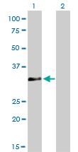HOXC4 Antibody - Western Blot analysis of HOXC4 expression in transfected 293T cell line by HOXC4 monoclonal antibody (M01), clone 1E9.Lane 1: HOXC4 transfected lysate(29.8 KDa).Lane 2: Non-transfected lysate.