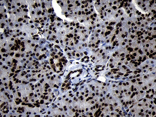 HOXC4 Antibody - Immunohistochemical staining of paraffin-embedded Human pancreas tissue within the normal limits using anti-HOXC4 mouse monoclonal antibody. (Heat-induced epitope retrieval by 1mM EDTA in 10mM Tris buffer. (pH8.5) at 120°C for 3 min. (1:2000)