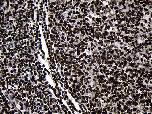 HOXC4 Antibody - Immunohistochemical staining of paraffin-embedded Human lymph node tissue within the normal limits using anti-HOXC4 mouse monoclonal antibody. (Heat-induced epitope retrieval by 1mM EDTA in 10mM Tris buffer. (pH8.5) at 120°C for 3 min. (1:2000)