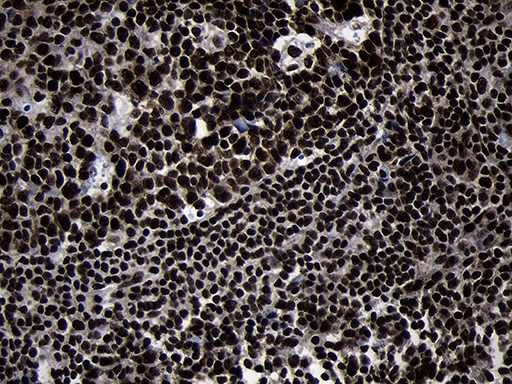 HOXC4 Antibody - Immunohistochemical staining of paraffin-embedded Human tonsil within the normal limits using anti-HOXC4 mouse monoclonal antibody. (Heat-induced epitope retrieval by 1mM EDTA in 10mM Tris buffer. (pH8.5) at 120°C for 3 min. (1:2000)