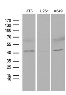 HOXC4 Antibody - Western blot analysis of extracts. (35ug) from 3 different cell lines by using anti-HOXC4 monoclonal antibody. (1:500)