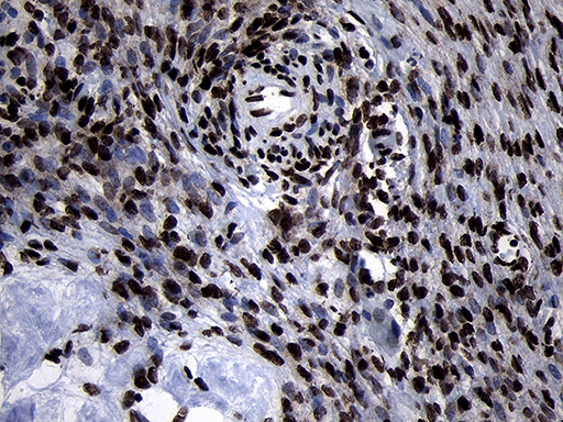 HOXC4 Antibody - Immunohistochemical staining of paraffin-embedded Human Ovary tissue within the normal limits using anti-HOXC4 mouse monoclonal antibody. (Heat-induced epitope retrieval by 1mM EDTA in 10mM Tris buffer. (pH8.5) at 120°C for 3 min. (1:2000)
