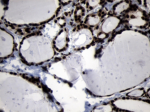 HOXC4 Antibody - Immunohistochemical staining of paraffin-embedded Human thyroid tissue within the normal limits using anti-HOXC4 mouse monoclonal antibody. (Heat-induced epitope retrieval by 1mM EDTA in 10mM Tris buffer. (pH8.5) at 120°C for 3 min. (1:2000)