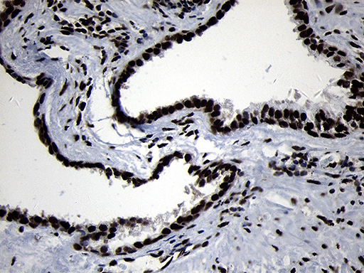 HOXC4 Antibody - Immunohistochemical staining of paraffin-embedded Human prostate tissue within the normal limits using anti-HOXC4 mouse monoclonal antibody. (Heat-induced epitope retrieval by 1mM EDTA in 10mM Tris buffer. (pH8.5) at 120°C for 3 min. (1:2000)