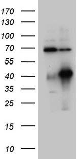 HOXC4 Antibody - HEK293T cells were transfected with the pCMV6-ENTRY control. (Left lane) or pCMV6-ENTRY HOXC4. (Right lane) cDNA for 48 hrs and lysed