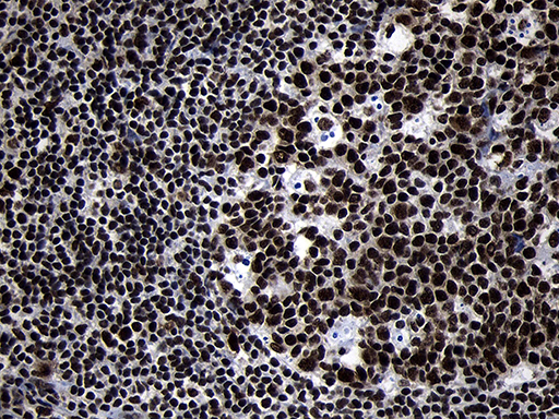HOXC4 Antibody - Immunohistochemical staining of paraffin-embedded Human tonsil within the normal limits using anti-HOXC4 mouse monoclonal antibody. (Heat-induced epitope retrieval by 1mM EDTA in 10mM Tris buffer. (pH8.5) at 120°C for 3 min. (1:2000)