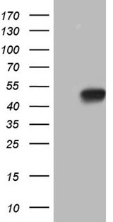 HOXC4 Antibody - HEK293T cells were transfected with the pCMV6-ENTRY control. (Left lane) or pCMV6-ENTRY HOXC4. (Right lane) cDNA for 48 hrs and lysed. Equivalent amounts of cell lysates. (5 ug per lane) were separated by SDS-PAGE and immunoblotted with anti-HOXC4. (1:2000)