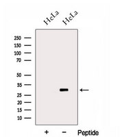HOXC4 Antibody - Western blot analysis of extracts of HeLa cells using HOXC4 antibody. The lane on the left was treated with blocking peptide.