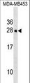 HOXC5 Antibody - Mouse Hoxc5 Antibody western blot of MDA-MB453 cell line lysates (35 ug/lane). The Hoxc5 antibody detected the Hoxc5 protein (arrow).