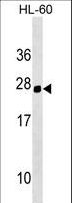 HOXC5 Antibody - Mouse Hoxc5 Antibody western blot of HL-60 cell line lysates (35 ug/lane). The Hoxc5 antibody detected the Hoxc5 protein (arrow).