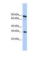 HOXC5 Antibody - HOXC5 antibody Western blot of THP-1 cell lysate. This image was taken for the unconjugated form of this product. Other forms have not been tested.