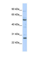 HOXC5 Antibody - HOXC5 antibody Western blot of 293T cell lysate. This image was taken for the unconjugated form of this product. Other forms have not been tested.