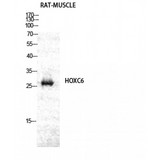 HOXC6 Antibody - Western blot of Hox-C6 antibody