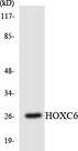 HOXC6 Antibody - Western blot analysis of the lysates from Jurkat cells using HOXC6 antibody.