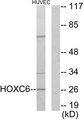 HOXC6 Antibody - Western blot analysis of lysates from HUVEC cells, using HOXC6 Antibody. The lane on the right is blocked with the synthesized peptide.