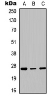 HOXC6 Antibody - Western blot analysis of HOXC6 expression in K562 (A); mouse brain (B); rat muscle (C) whole cell lysates.