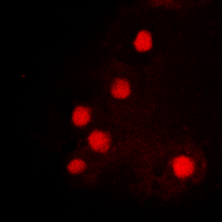 HOXC6 Antibody - Immunofluorescent analysis of HOXC6 staining in K562 cells. Formalin-fixed cells were permeabilized with 0.1% Triton X-100 in TBS for 5-10 minutes and blocked with 3% BSA-PBS for 30 minutes at room temperature. Cells were probed with the primary antibody in 3% BSA-PBS and incubated overnight at 4 deg C in a humidified chamber. Cells were washed with PBST and incubated with a DyLight 594-conjugated secondary antibody (red) in PBS at room temperature in the dark. DAPI was used to stain the cell nuclei (blue).