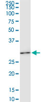 HOXC6 Antibody - HOXC6 monoclonal antibody (M04), clone 2A4. Western Blot analysis of HOXC6 expression in HeLa NE.
