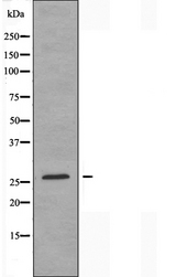 HOXC6 Antibody - Western blot analysis of extracts of HuvEc cells using HOXC6 antibody.