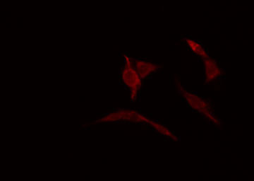 HOXC6 Antibody - Staining HuvEc cells by IF/ICC. The samples were fixed with PFA and permeabilized in 0.1% Triton X-100, then blocked in 10% serum for 45 min at 25°C. The primary antibody was diluted at 1:200 and incubated with the sample for 1 hour at 37°C. An Alexa Fluor 594 conjugated goat anti-rabbit IgG (H+L) antibody, diluted at 1/600, was used as secondary antibody.