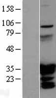 HOXC6 Protein - Western validation with an anti-DDK antibody * L: Control HEK293 lysate R: Over-expression lysate