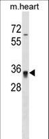 HOXC8 Antibody - Mouse Hoxc8 Antibody western blot of mouse heart tissue lysates (35 ug/lane). The Hoxc8 antibody detected the Hoxc8 protein (arrow).