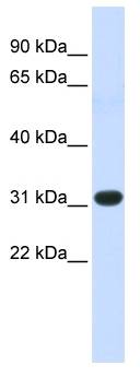 HOXC8 Antibody - Western analysis of fetal muscle lysate.  This image was taken for the unconjugated form of this product. Other forms have not been tested.
