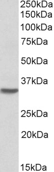 HOXC8 Antibody - Goat Anti-HOXC8 Antibody (0.1µg/ml) staining of Mouse Spinal Cord lysate (35µg protein in RIPA buffer). Primary incubation was 1 hour. Detected by chemiluminescencence.
