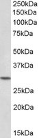 HOXC8 Antibody - HOXC8 antibody (0.1 ug/ml) staining of Peripheral Blood Lymphocytes lysate (35 ug protein/ml in RIPA buffer). Primary incubation was 1 hour. Detected by chemiluminescence.