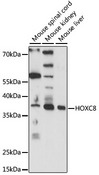 HOXC8 Antibody - Western blot analysis of extracts of various cell lines, using HOXC8 antibody at 1:1000 dilution. The secondary antibody used was an HRP Goat Anti-Rabbit IgG (H+L) at 1:10000 dilution. Lysates were loaded 25ug per lane and 3% nonfat dry milk in TBST was used for blocking. An ECL Kit was used for detection and the exposure time was 1s.