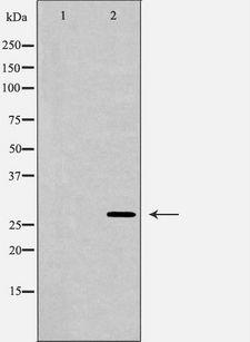 HOXC8 Antibody - Western blot analysis of extracts of U251 using HOXC8 antibody. The lane on the left is treated with the antigen-specific peptide.